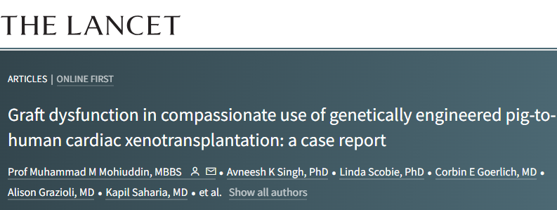 Case Report: Compassionate use of genetically engineered pig-to-human cardiac xenotransplantation